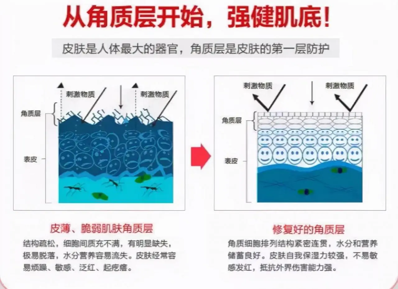 怎么样才能去红血丝(解析去红血丝有效的方法)插图3 怎么样才能去红血丝(解析去红血丝有效的方法)插图3