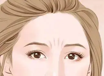 抬头纹川字纹怎么快速去除（分享川字纹怎么去除效果快）插图