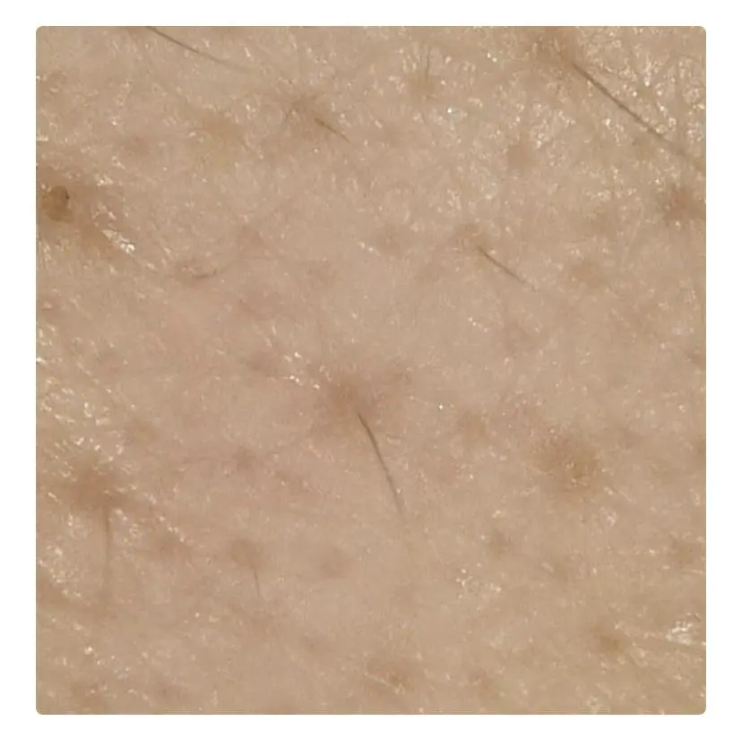 黑头导出液怎么用的（介绍怎样让这样脏兮兮的脸变得白净点）插图12