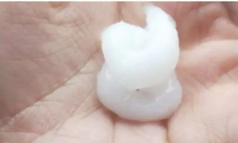 黑头导出液怎么用的(介绍怎样让这样脏兮兮的脸变得白净点)插图14 黑头导出液怎么用的(介绍怎样让这样脏兮兮的脸变得白净点)插图14