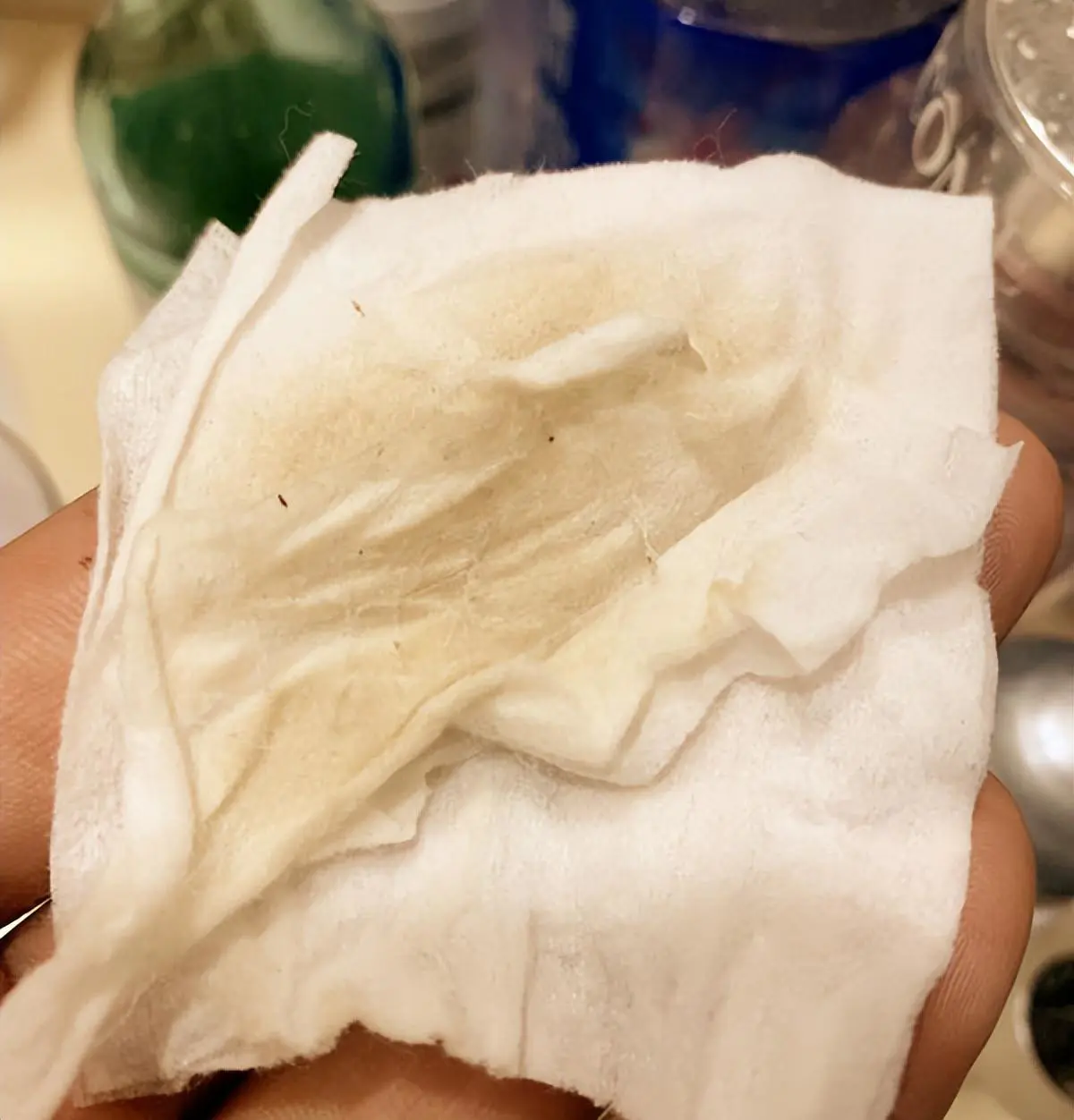 黑头导出液怎么用的(介绍怎样让这样脏兮兮的脸变得白净点)插图24 黑头导出液怎么用的(介绍怎样让这样脏兮兮的脸变得白净点)插图24