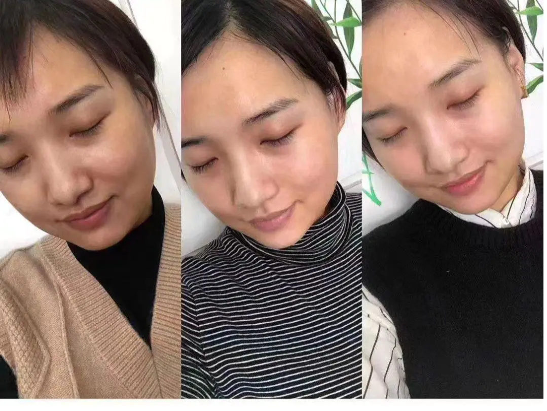 黑头导出液怎么用的(介绍怎样让这样脏兮兮的脸变得白净点)插图25 黑头导出液怎么用的(介绍怎样让这样脏兮兮的脸变得白净点)插图25