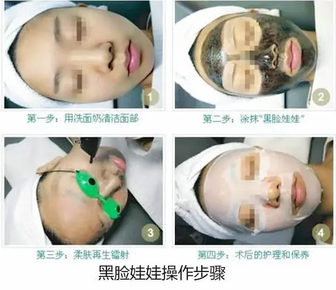 黑脸娃娃怎么样（解析黑脸娃娃美白嫩肤的效果怎么样）插图1