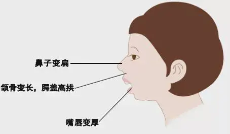怎么样可以瘦脸(浅谈学会这些让你轻松瘦脸)插图2 怎么样可以瘦脸(浅谈学会这些让你轻松瘦脸)插图2