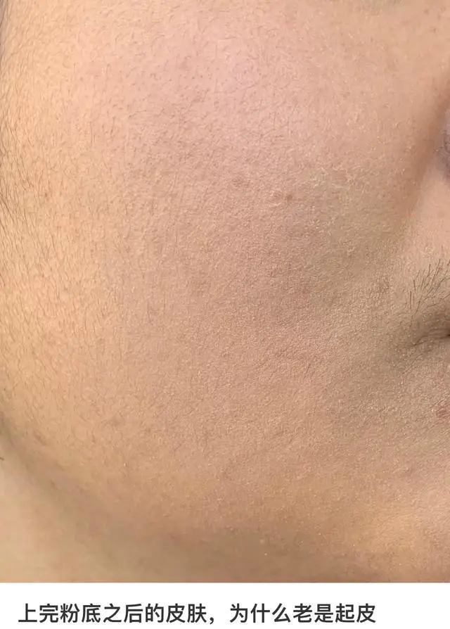 怎么用粉底液看着自然(分析学会这几个技巧妆容服帖又自然)插图2 怎么用粉底液看着自然(分析学会这几个技巧妆容服帖又自然)插图2