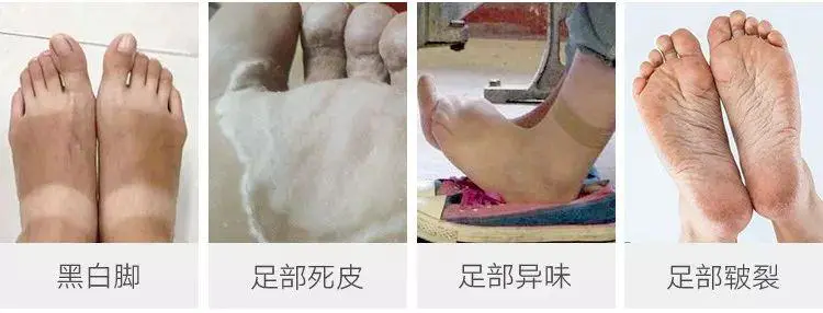 怎么样让脚变嫩滑（浅谈用这个方法洗脚脚比脸还嫩滑）插图