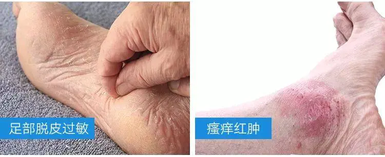 怎么样让脚变嫩滑（浅谈用这个方法洗脚脚比脸还嫩滑）插图6