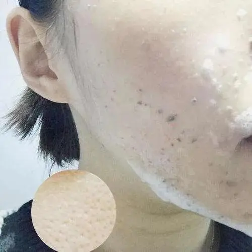 怎么样让脸变得干净(解析如何让自己的脸看起来更干净)插图 怎么样让脸变得干净(解析如何让自己的脸看起来更干净)插图