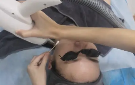 做黑脸娃娃效果怎么样（讲解比美白针靠谱的美白项目有哪些）插图8