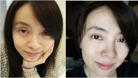 怎么样才能快速美白(讲解如何在两周内快速美白)插图1 怎么样才能快速美白(讲解如何在两周内快速美白)插图1