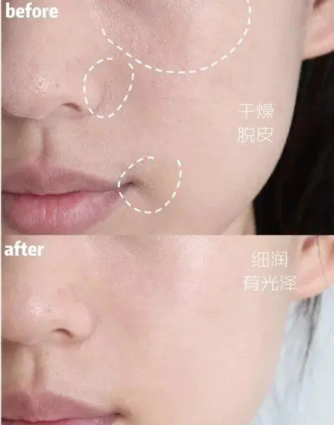 爱和纯护肤品怎么样(解读AHC神仙水乳套装功效心得)插图4 爱和纯护肤品怎么样(解读AHC神仙水乳套装功效心得)插图4